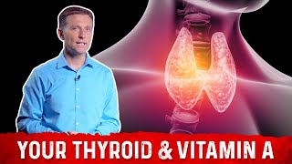 Thyroid amp Importance of Vitamin A – DrBerg [upl. by Pontius]