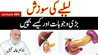 Inflammation of pancreas  How to protect  lecture 484 [upl. by Chandless838]