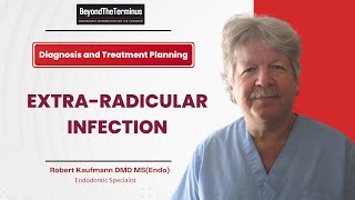 Solving the Mystery of ExtraRadicular Infections in Endodontics [upl. by Odracir250]