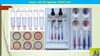 Precipitation and Agglutination Tamil Part 4 [upl. by Ailongam]