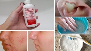 7 Surprising Uses for Hydrogen Peroxide [upl. by Melvin]