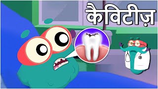 कैविटीज़  दांतों में कीड़े  Cavities In Hindi  DrBinocs Show  Educational Videos For Kids [upl. by Lissie]