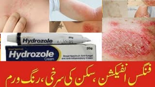 Hydrozole cream  Hydrozole Clotrimazole Hydrocortisone Uses and side effects in urdu and Hindi [upl. by Nniroc]