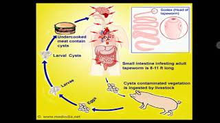 Neurocysticercosis [upl. by Rolfe455]