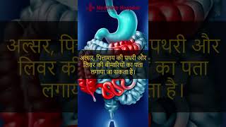 पेट का अल्ट्रासाउंड क्यों आवश्यक है  Abdominal Ultrasound  Best Gastro Hospital in Kanpur [upl. by Eelsew534]