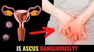 Is ASCUS Dangerously [upl. by Hueston359]