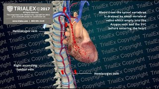 The Mechanism of DIC  Disseminated Intravascular Coagulation [upl. by Jody762]