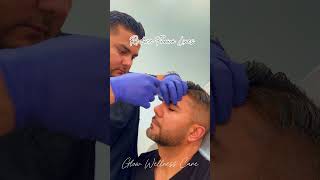 Glabella Botox at Glow Wellness Care [upl. by Annekim]