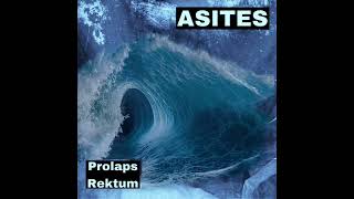 Asites  Prolaps Rektum 2024 [upl. by Hellene]