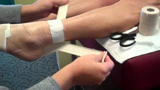 Taping for Achilles Tendinitis [upl. by Gelb]