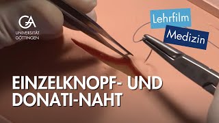 Einzelknopf und DonatiNaht [upl. by Mignon]