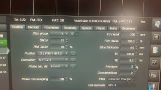 Adjusting MRI Parameters while Scanning [upl. by Bauske53]