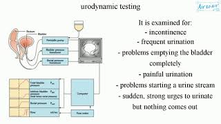 urodynamic testing [upl. by Enilesoj]