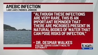 Person gets sick dies from amebic infection after swimming in Lake Lyndon B Johnson [upl. by Ecilegna568]