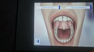 introduction to dental anatomy Dentition [upl. by Oliana306]