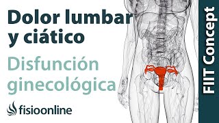 Disfunciones ginecológicas y dolor de espalda lumbar y ciático  Causas y tratamiento [upl. by Krasner]