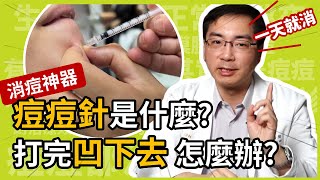 痘痘針真的是消痘神器？打完皮膚凹下去怎麼辦？皮膚科林政賢醫師要提醒你，六大注意事項！ [upl. by Minabe127]