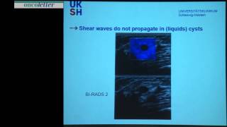 Fritz Schäfer Elastography  overview and usefulness [upl. by Edia175]