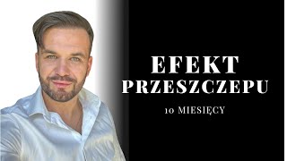 EFEKTY PRZESZCZEPU WŁOSÓW  10 miesięcy [upl. by Suoicul146]