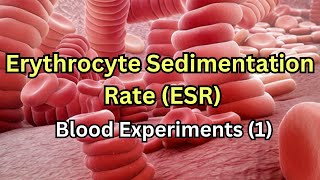 Erythrocyte Sedimentation Rate ESR  Blood experiments 1 [upl. by Aonehc]