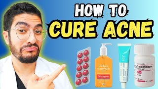 99 Overlook These Effective Acne Treatments – 2024 Guide [upl. by Saoj]