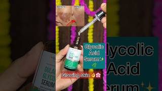 Dr Sheiths Gulab amp Glycolic Acid Serum Foreventoned amp spotless skin skincare serum shots [upl. by Oza]