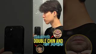 Remove Double Chin and Get Sharp Jawline [upl. by Niamor]