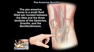 Pes Anserine Bursitis  Everything You Need To Know  Dr Nabil Ebraheim [upl. by Seugirdor]