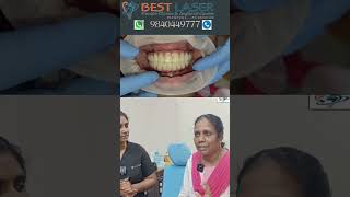 வலி இல்லாத முழுவாய் உடனடி இம்ப்ளாண்ட் சிகிச்சைPainless immediate dental implantsFixed teeth price [upl. by Thaddaus]