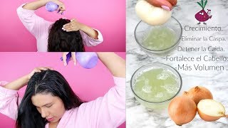 Jugo de Cebolla Para Eliminar la Caspa Hacer crecer el cabello y Detener la Caida fashionbycarol [upl. by Yahsal951]