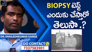 Biopsy Test in Hyderabad  What is biopsy  Why and How biopsy is done  Citi Vascular Hospital [upl. by Renado900]