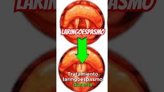 LARINGOESPASMO previo a INTUBACIÓN 🤙🏻 emergency anestesia [upl. by Hephzibah501]