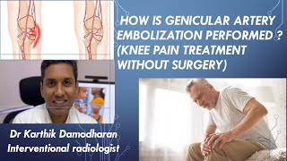 HOW IS GENICULAR ARTERY EMBOLIZATION PERFORMED  KNEE PAIN TREATMENT WITHOUT SURGERY [upl. by Tarttan]