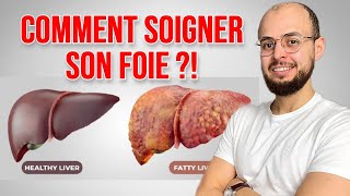 Comment soigner le FOIE GRAS Stéatose hépatique [upl. by Markowitz]