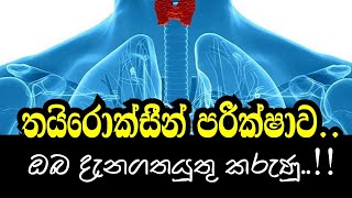 Thyroid Function Tests Sinhala  තයිරොක්සීන් පරීක්ෂාව [upl. by Tenay]