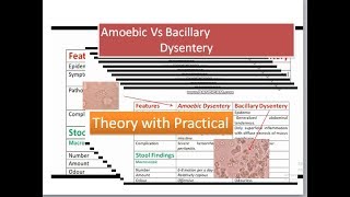 Amoebic Dysentery versus bacillary dysentery [upl. by Rempe]