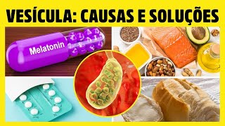 CAUSAS OCULTAS QUE DANIFICAM SUA VESÍCULA  SOLUÇÕES E TRATAMENTOS NATURAIS  Dr Alain Dutra [upl. by Nosidam]