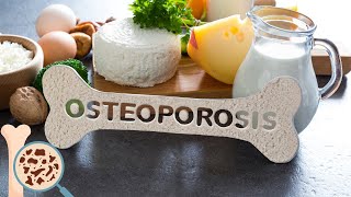 Osteoporosis  Everything You Need To Know [upl. by Narag]