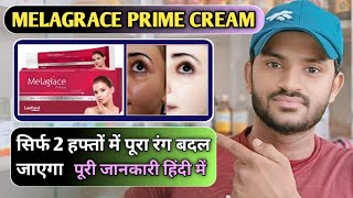 Melagrace prime cream use dose benefits and side effect Full review in hindi [upl. by Solnit280]