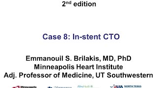 Case 8 Manual of CTO Interventions  Investment for ISR CTO [upl. by Nadabus213]