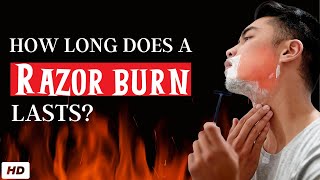 how Long Does A Razor Burn Or Bump Last [upl. by Yrtua]