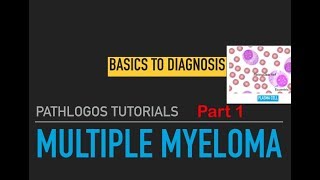 Multiple myeloma Pathology lecture Part 1 [upl. by Taima380]