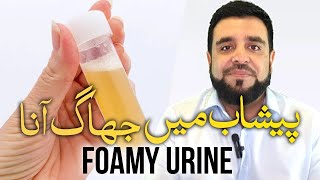 Peshab Me Jhaag Aana  Foamy Urine Uncover The Causes amp Treatments For Bubbly Pee [upl. by Annav891]