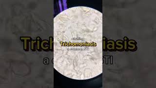 Trichomonas vaginalis 😲 urine microbiology parasite lab laboratory analysis [upl. by Farley774]