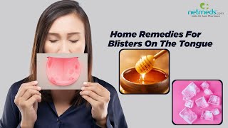 Blisters On The Tongue 6 Effective Home Remedies [upl. by Kcirddehs773]