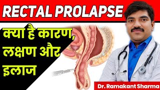 Rectal Prolapse Causes Symptoms and Treatmentdrramakantsharma7 [upl. by Manuela]