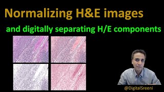 122  Normalizing HampE images and digitally separating Hematoxylin and Eosin components [upl. by Elleirda845]