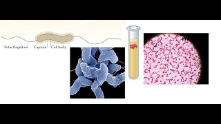 Campylobacter jejuni Part 1 Introduction Biochemical Properties and Virulence factors [upl. by Toback]