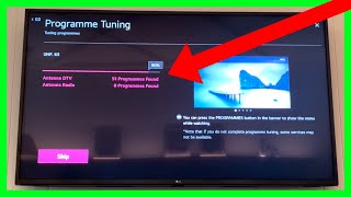 How to Get Local Channels on LG TV How to Watch Live TV Freeview in LG Smart TV [upl. by Stace]