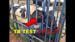 TB TEST FAIL [upl. by Gnoc766]